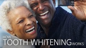 get-dentist-in-seattle