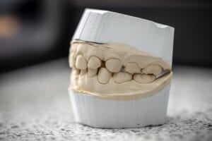 dental bone graft surgery basics
