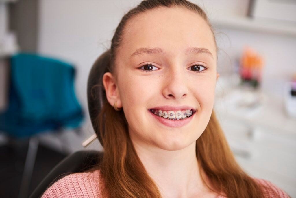 Should Adults Get Braces Dos And Donts Icon Dental Center