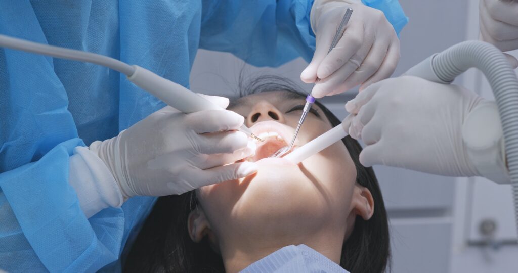 The different types of dental filling material compared