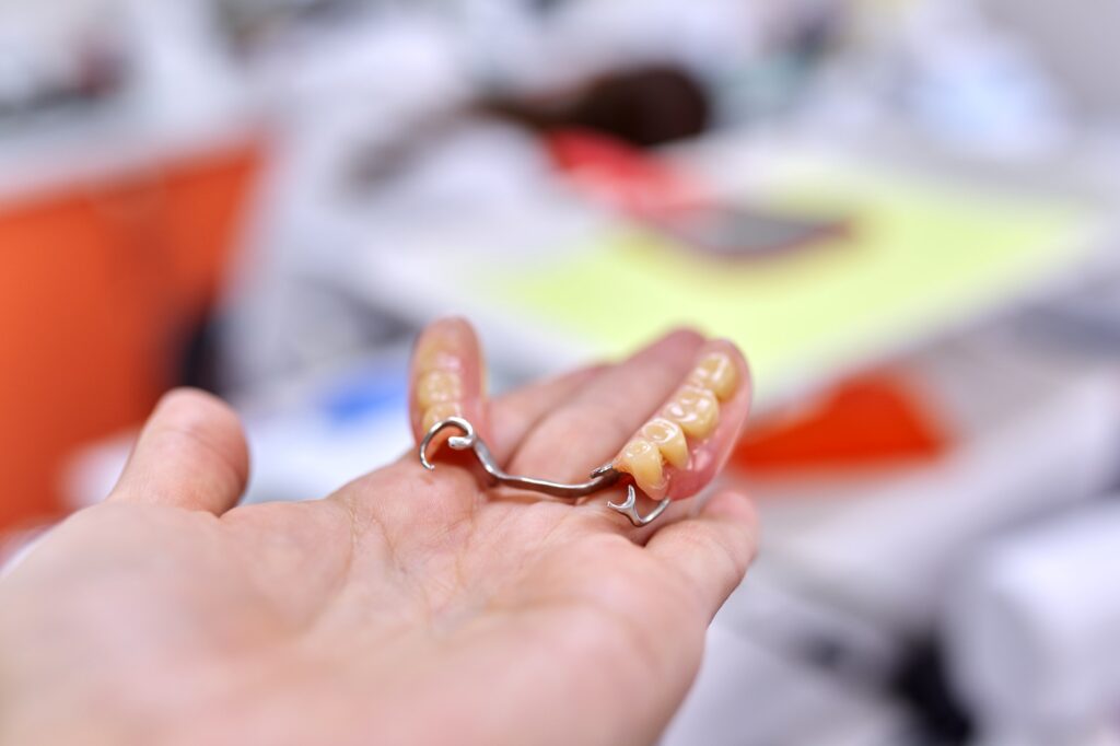 dental bridges