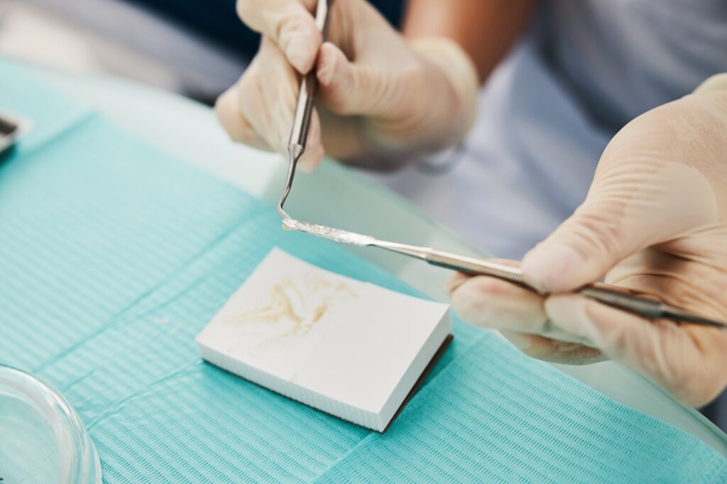 Composite and amalgam filling materials side by side