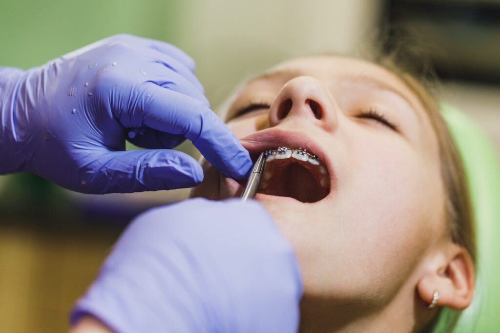 The Medical Benefits Of Braces According To Top Dentists