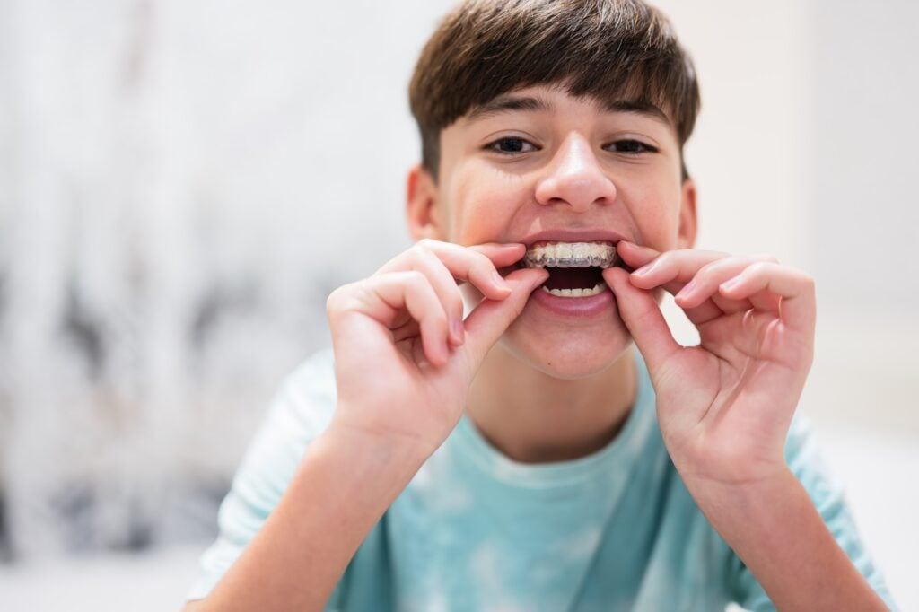 best orthodontic options for teenagers