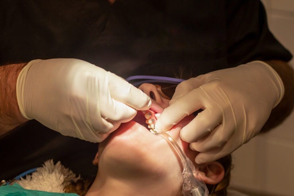 Close view of orthodontic brackets and archwire during an adjustment