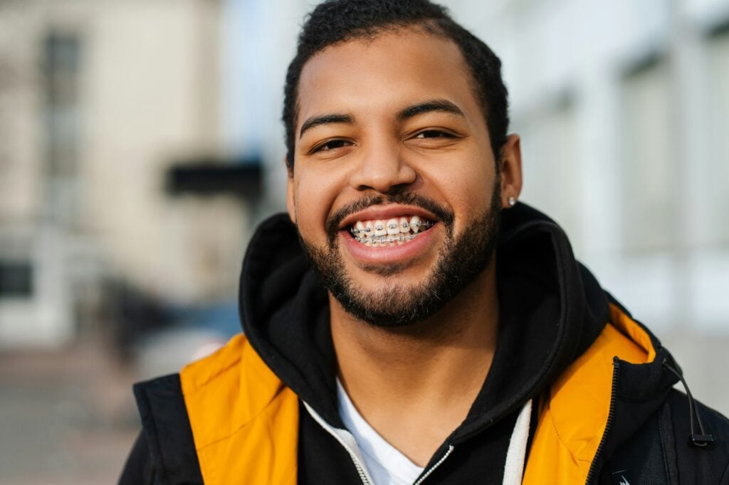 braces for adults