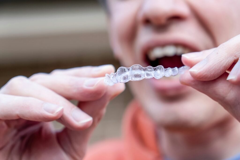 invisalign care tips for teens