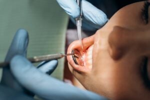 Dental instruments working at a patient's gum line during treatment