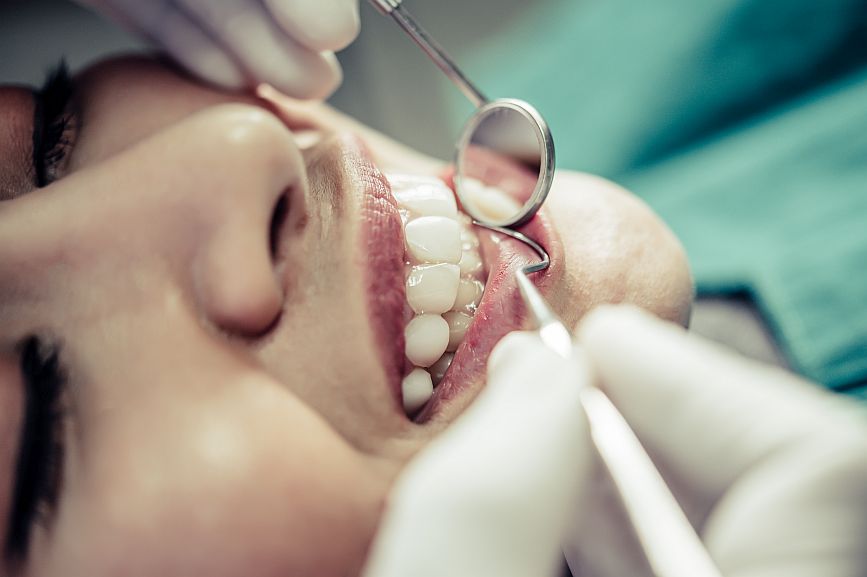 Gum grafting treatment for receding gums at Icon Dental Center in Everett, WA